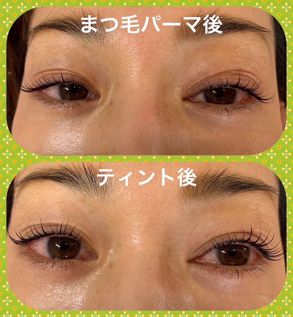 まつぱ後、ティント後